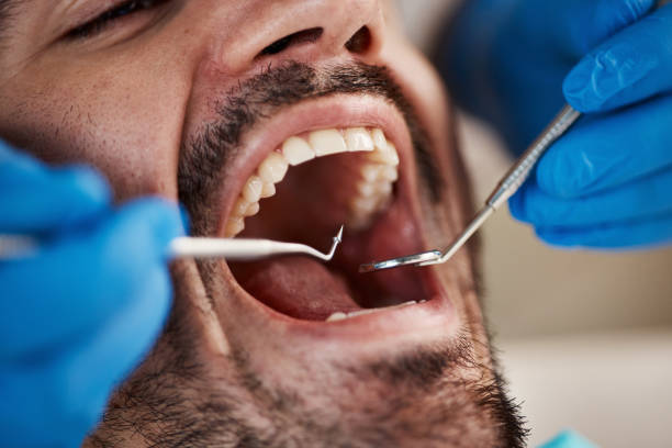 Best Emergency Dental Care for Broken or Chipped Teeth in Rosamond, CA